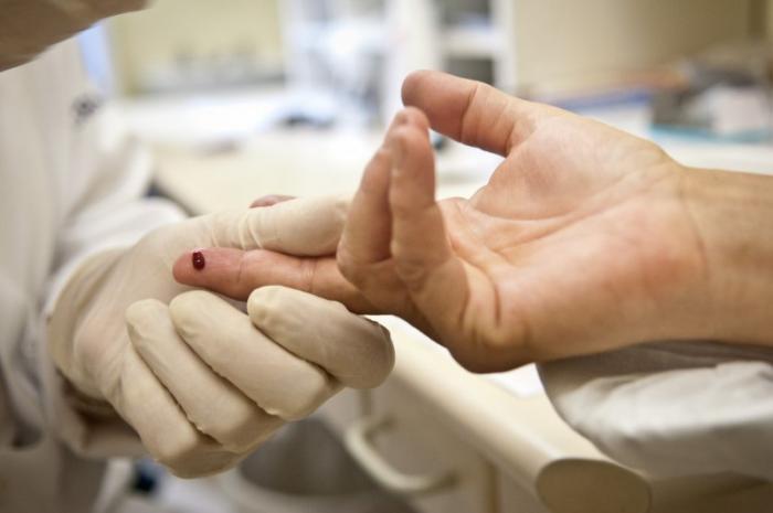 Menos da metade dos infectados por HIV e tuberculose tomam antirretroviral